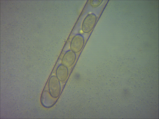 Cheilymenia theleboloides